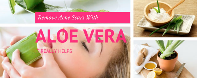 How Long Does Aloe Vera Take To Fade Scars I ve Lost This Problem And 